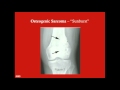 Orthopedic Tumors - CRASH! Medical Review Series