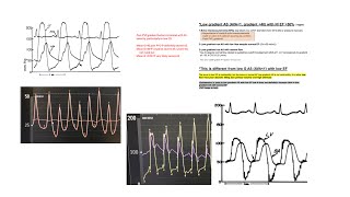 Hemodynamic cases - part 1