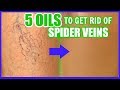 HOW TO GET RID OF SPIDER VEINS WITH ESSENTIAL OILS! │ TOP 5 OILS TO FADE AND ERASE VARICOSE VEINS!