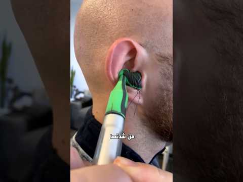 لماذا يسحبون أذن السائق بعد السياق 