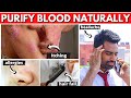 How to Purify Your Blood Naturally?