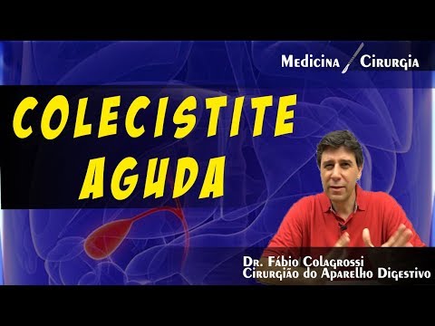 Vídeo: Doença De Colecistite - Tipos, Sintomas De Colecistite Aguda E Crônica, Colecistite Calculosa, Ataque De Colecistite