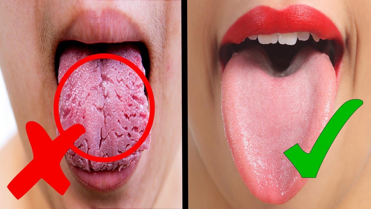What Your Tongue Reveals About Your Health Youtube
