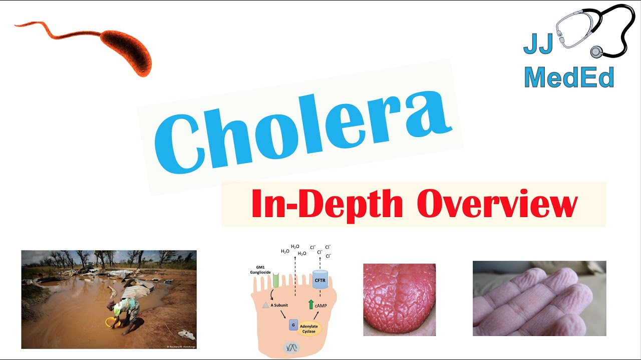 Kampf gegen die Cholera | Projekt Zukunft