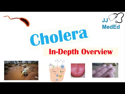 Cholera (Vibrio Cholerae) Pathophysiology, Risk Factors, Symptoms, Diagnosis, and Treatment