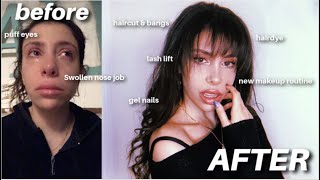 AFTER NOSE JOB GLOW UP 2020 | feat. DOSSIER