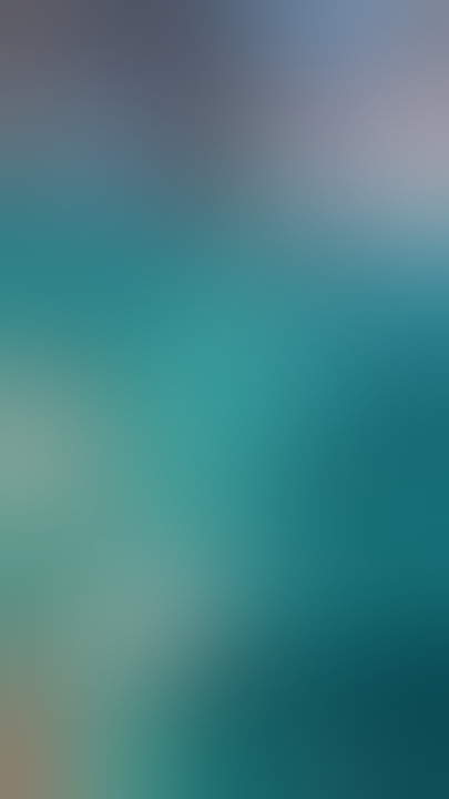 Rod removal after fracture healing- Are long bones hollow? #bones #fracture