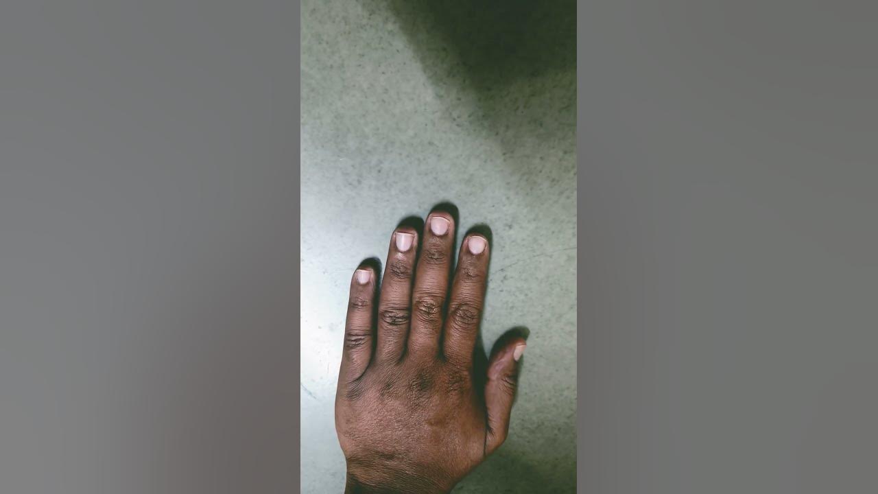 dehydration test with fingers🤚//viral video//ytshorts YouTube