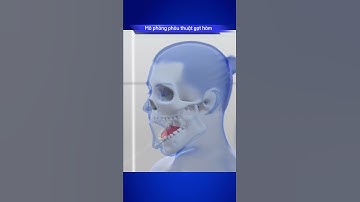 MÔ PHỎNG PHẪU THUẬT GỌT HÀM