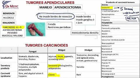 ¿Son siempre cancerosos los tumores intestinales?