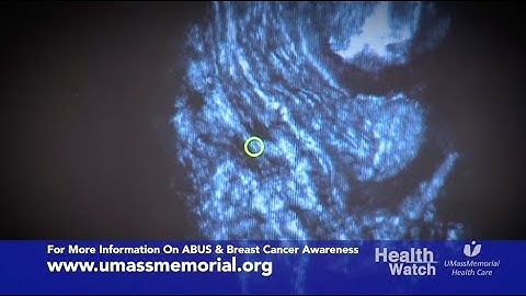 Health Watch: Automated Breast Ultrasound Screening