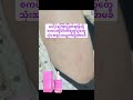 #margoserum#ကြားဖြူ #foryou #trending