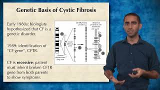 WGS vs. WES 1: Discovery of a gene implicated in cystic fibrosis