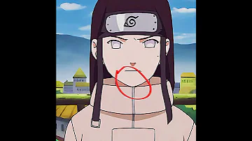 Sasuke And Neji Glow Up Naruto Sasuke Sasukeuchiha Neji Neji Spyxfamily Anya Spy X Family 