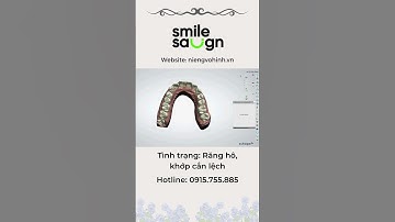 Phác đồ niềng răng - Smilesalign Việt Nam