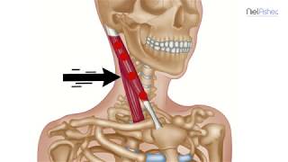 How To Find Trigger Points - Sternocleidomastoid (Head and Ear Pain)