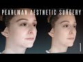 Rhinoplasty preop 3d imaging with dr steven pearlman  part 1