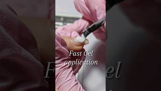 Fast Gel Application