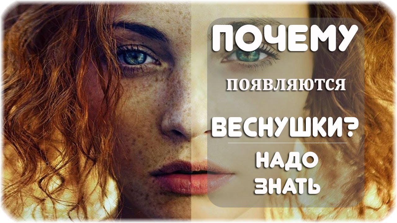Почему появляются веснушки? - YouTube