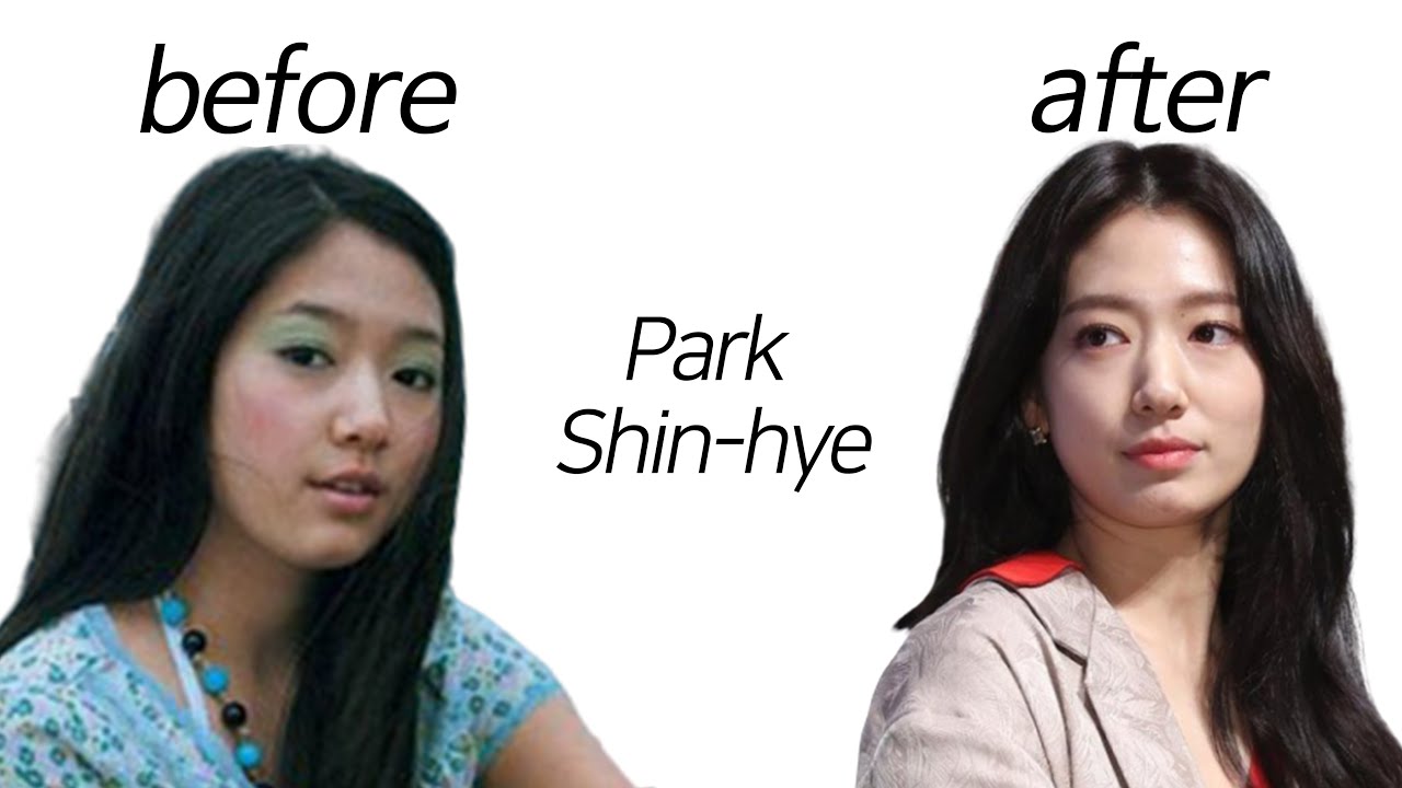 Park Shin-hye before and after 