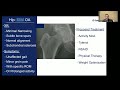Inova Ask the Expert: Hip replacement in 2025 — Techniques, robotics and better outcomes