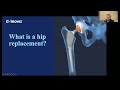 Inova Ask the Expert: Hip replacement in 2025 — Techniques, robotics and better outcomes
