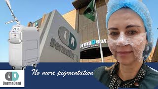 Getting  rid of pigmentation in one session help of Dermadent & Picoway by mamalize 239 views 2 years ago 3 minutes, 33 seconds