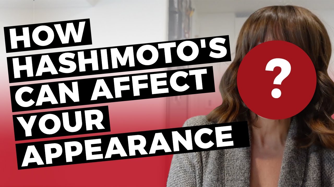 HASHIMOTOS DISEASE SYMPTOMS How it affects my appearance. YouTube