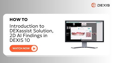 DEXIS™ Imaging Suite - Introductie tot de DEXassist-oplossing, 2D AI-bevindingen in DEXIS 10