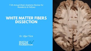 White Matter Fibers Dissection - Uğur Türe, MD screenshot 5