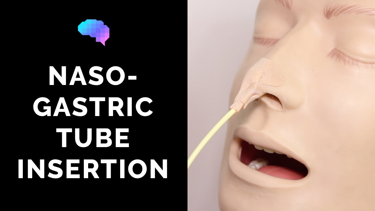 Aspiration Examples Nasogastric Ng Tube Insertion Osce Guide Meaning Funny