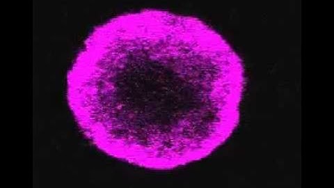 Breast epithelial cells forming acini in 3D