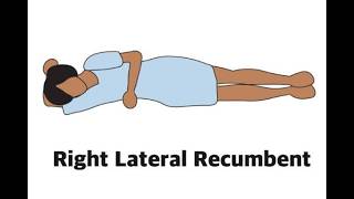 lateral recumbent position; medical anatomical term, body posture where a person lies on their side