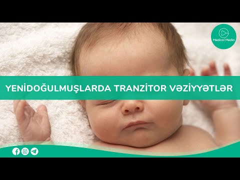 Video: Yenidoğulmuşlarda Inanılmaz Kəşflər: Bu Dövrdə Inkişaf Xüsusiyyətləri