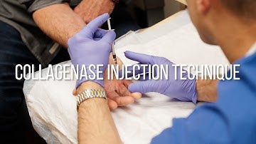 Collagenase Injection Technique for Dupuytren