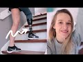 Amputee Climbing STAIRS First Time w/o Help!!