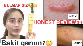 Lanbena Tcm Scar Remover Honest Review Mabisa Ba?