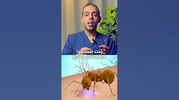 علاج قرصة النملة وليه بتوجعنا طب Shorts 