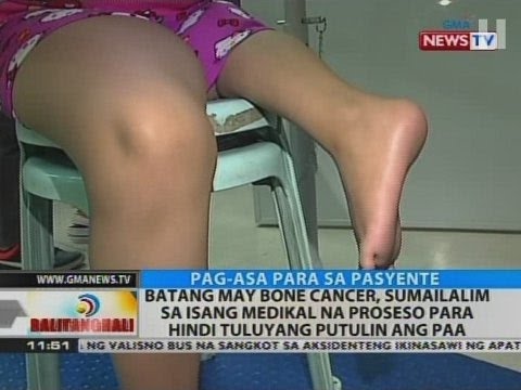 Video: Paano Gamutin Ang Sakit Sa Buto Sa Mga Bata