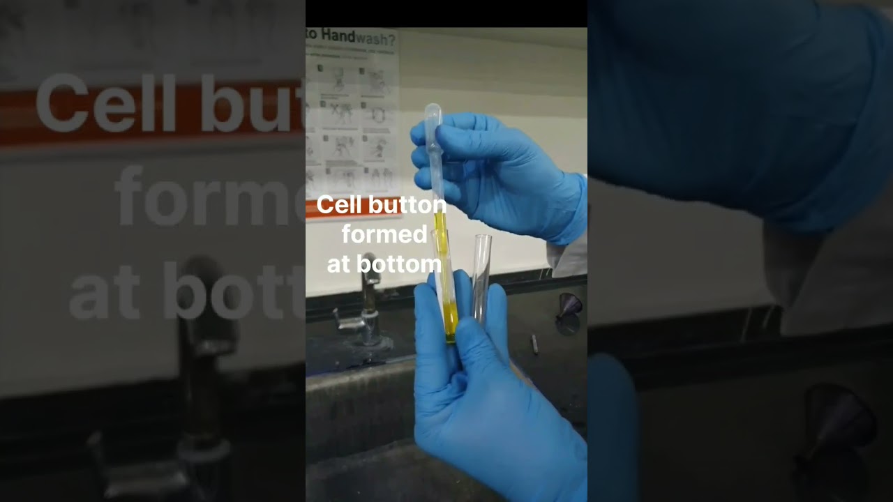 Preparation of cell button and slide for fluid  cytology.