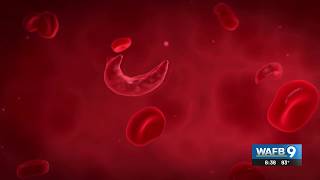 Sickle cell gene therapy cure comes with access challenges for Louisiana patients