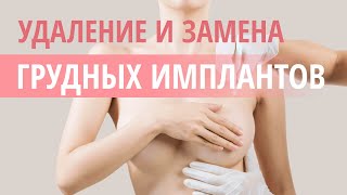 👩‍⚕️  Реэндопротезирование грудных имплантов