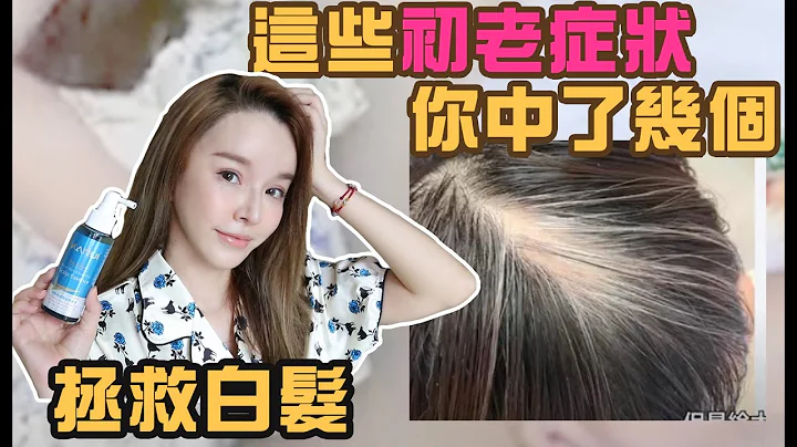 天啊这些地方会被看出年纪!初老症状你中了哪些？白发/掉发/动作😩 - 天天要闻