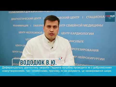 Захворювання Педжета, рак соска - Володимир Юрійович Вододюк