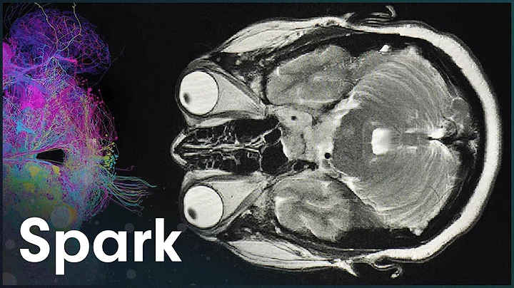 Are We Still Evolving, Or Has Humanity Peaked?