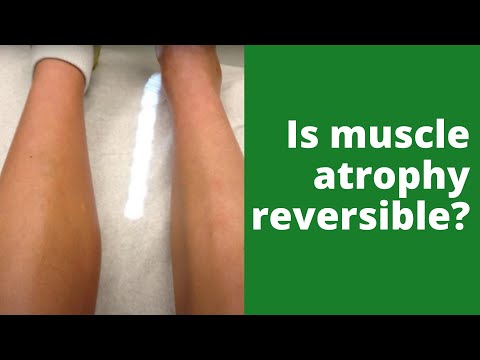 Video: Ar atrofuoti raumenys grįžta?