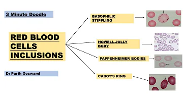 Red Blood Cell Inclusions in PS | Images | Doodle Animation Made easy