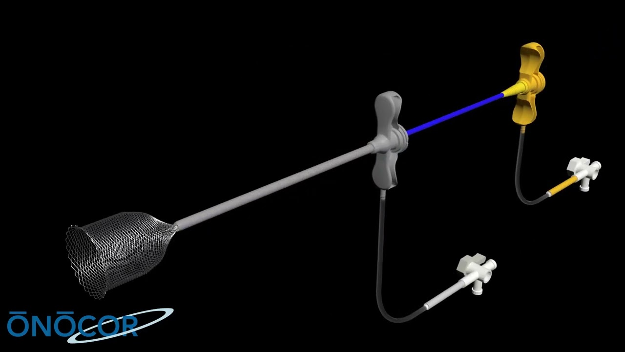 Preview image for video