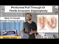Male To Female Gender Change Surgery In India Delhi Mumbai Bangalore Kolkata Hyderabad Chandigarh