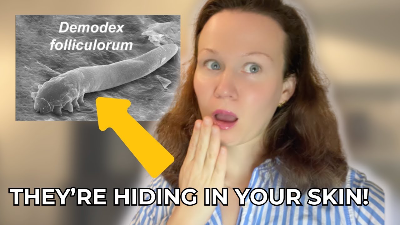The Secret Life of Face Mites – What Demodex Are Doing on Your Skin?